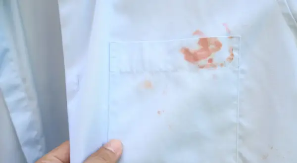Plama rdzy na białej koszuli. Dowiedz się, jak usunąć rdzę z ubrania białego, aby przywrócić mu nieskazitelny wygląd.