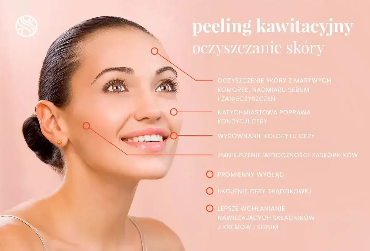 Peeling kawitacyjny i skutki uboczne - co warto wiedzieć