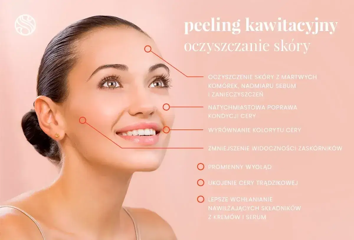 Uśmiechnięta kobieta z promienną cerą. Peeling kawitacyjny oczyszcza skórę, poprawia jej kondycję i koloryt, bez skutków ubocznych.